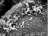 Gut cells and propionibacteria
